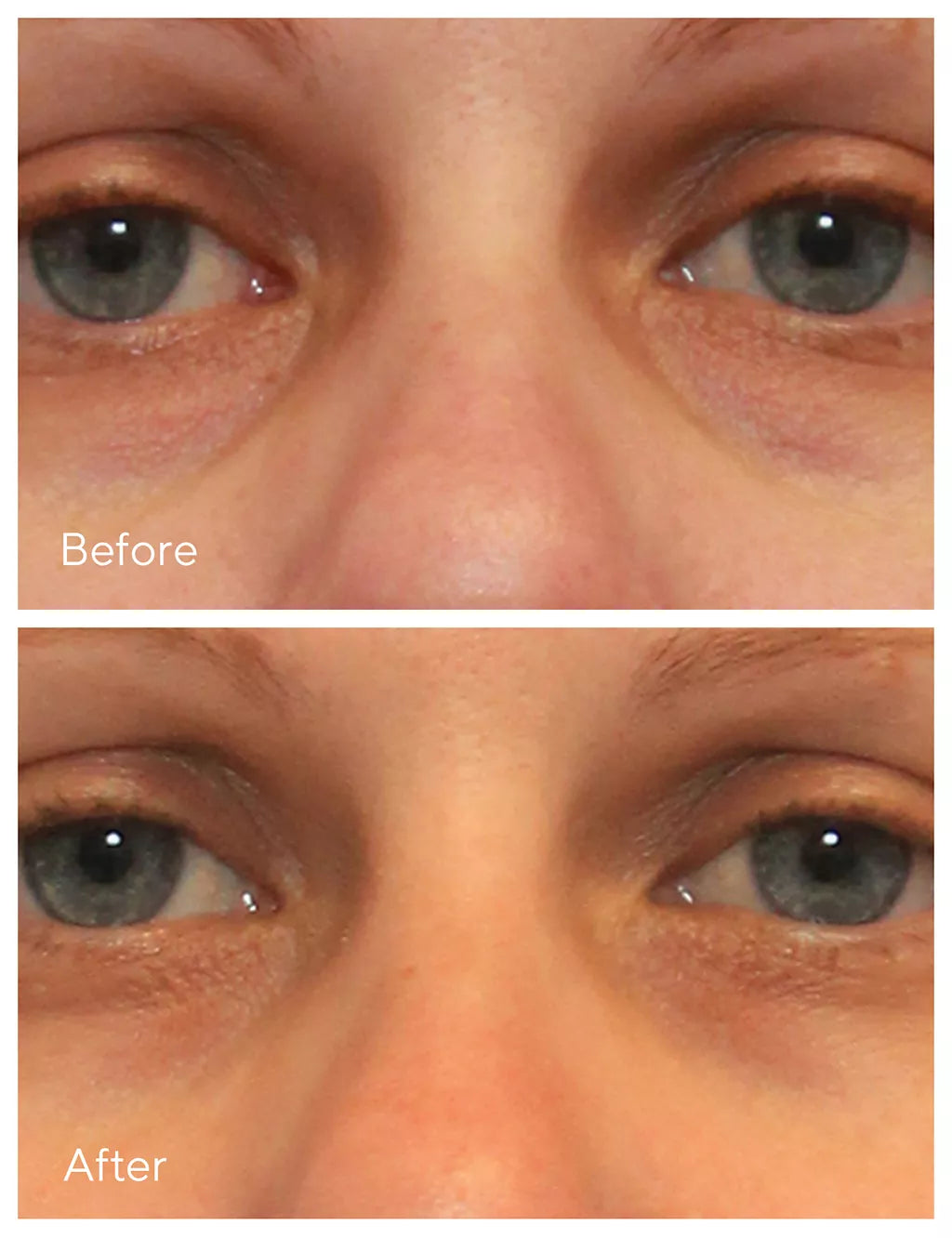 Vita-C Eyes Dark Circle Corrector 15ml Body Care M&S