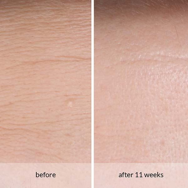 Avon Anew Anti-Wrinkle Smoothing Serum - McGrocer