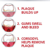 Corsodyl Gum Mouthwash Intensive Treatment For Gum Health Mint 300ml