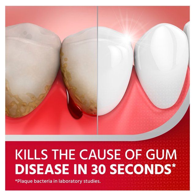 Corsodyl Gum Mouthwash Intensive Treatment For Gum Health Mint 300ml