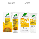 Dr Organic Vitamin E Scar & Stretch Mark Serum 50ml