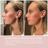 SENSSE LED Light Therapy Mask