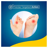 Scholl Wart &amp;amp; Verruca Freeze Spray   80ml